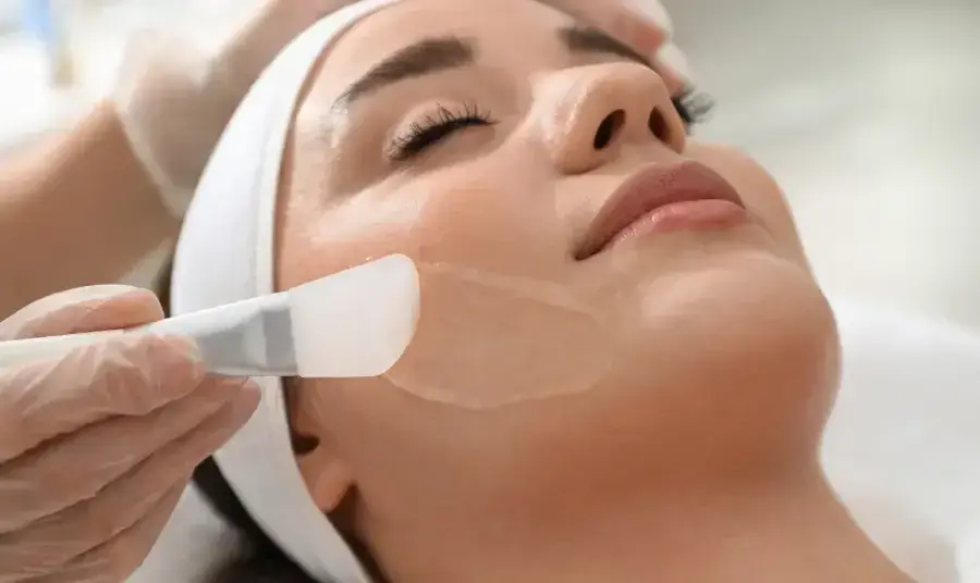 A chemical peel is a cosmetic skin treatment that involves the application of a carefully formulated acid solution to exfoliate and remove the outermost layers of the skin.