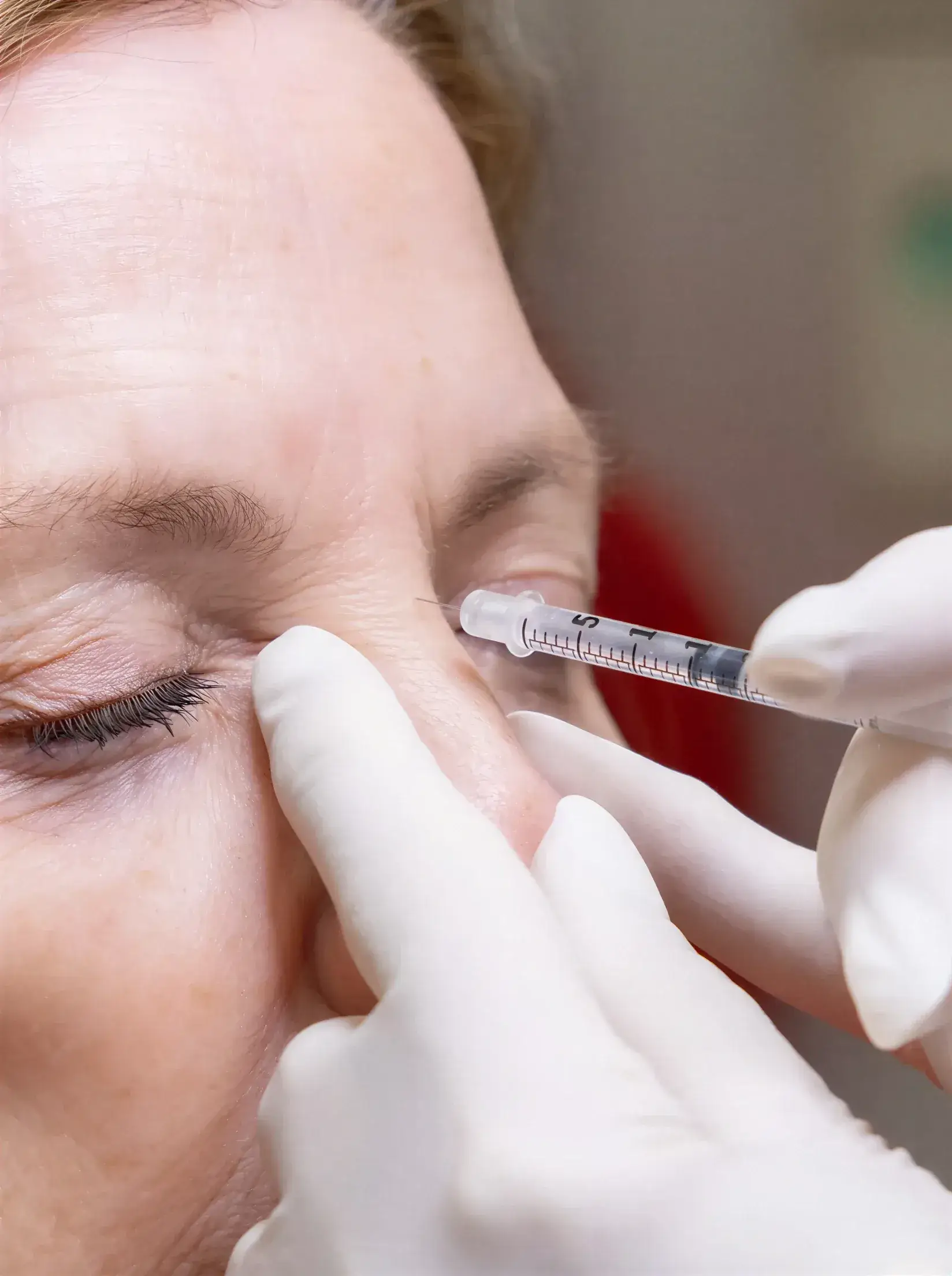 A gloved provider administering a Dysport injection near a client's brow at Well Labs+ Dallas