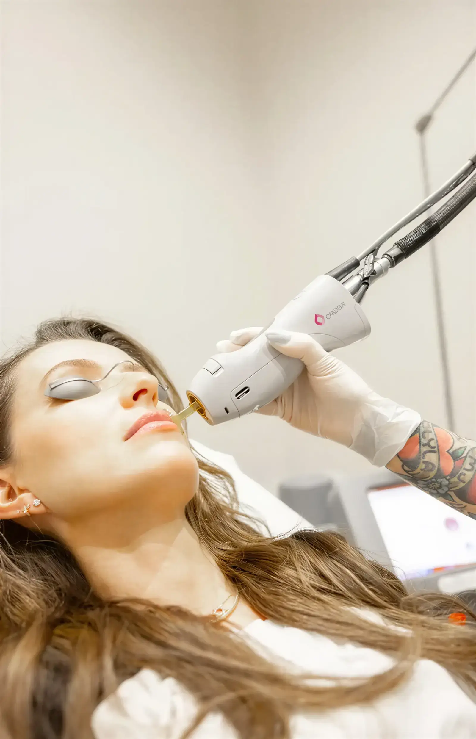 A Well Labs+ provider performing a laser hair removal treatment on a client's face with a Candela laser handpiece