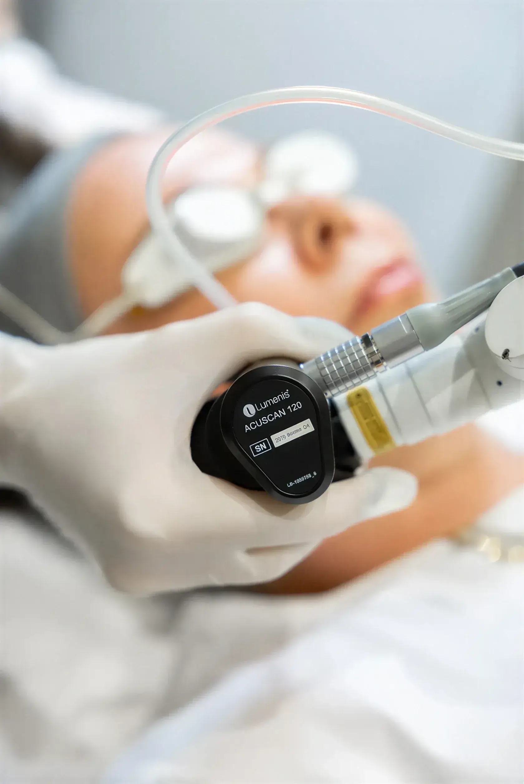 A Well Labs+ provider performing a laser tattoo and permanent makeup removal treatment with a Lumenis handpiece