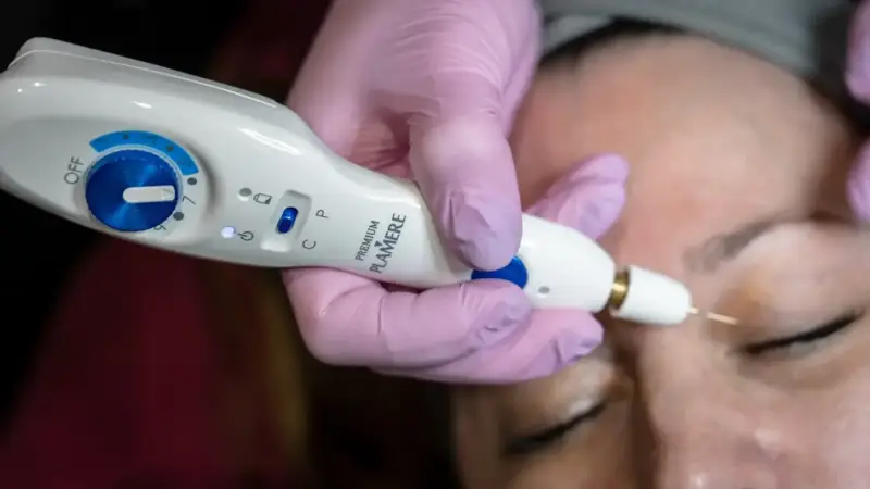 The Top 3 (ANTI) Aging Eye Treatments in Dallas You MUST Try in 2021