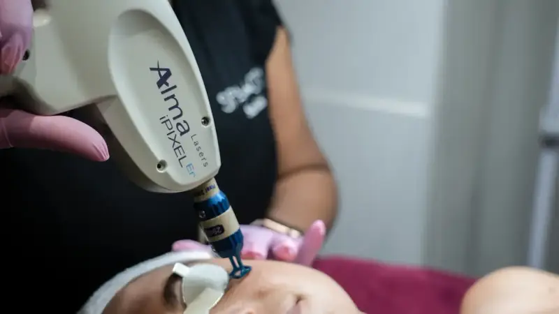 Your Laser Skin Resurfacing Questions Answered by Dallas Skincare Specialists