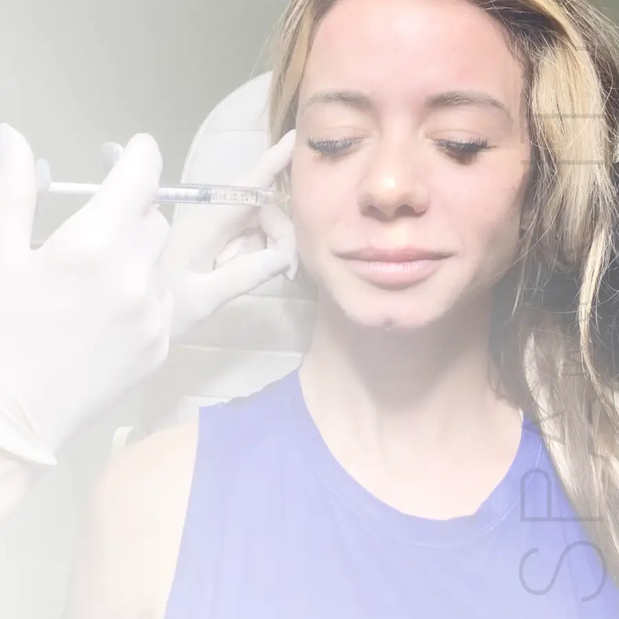 woman receiving face fillers in Dallas at Spa in the City