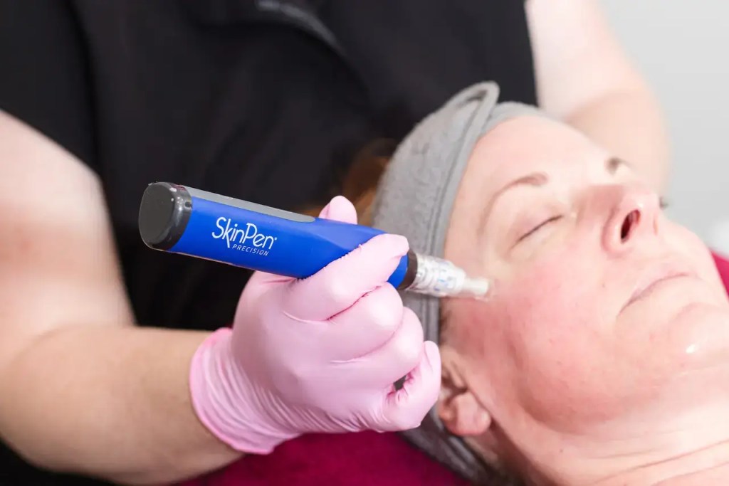 How Non-Surgical Lifting Is Changing Aesthetics