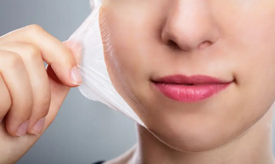Chemical peels can be an excellent solution for individuals with oily, acne-prone skin or those dealing with post-acne marks and surface-level scarring.