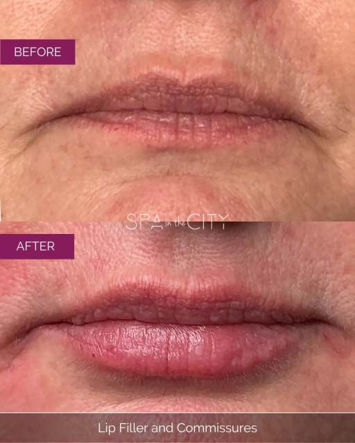 Refined, hydrated, effortlessly lifted💋

☎️Call today 214-238-2251 to start your
Path to Fabulous
📍 5009 W Lovers Lane Dallas, Tx
💻 www.spainthecitydallas.com
🌟 Ask about our new client special