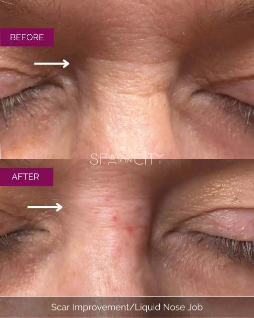 Clean lines & effortless balance.
No downtime… just elevation. 😏✨

☎️Call today 214-238-2251 to start your
Path to Fabulous
📍 5009 W Lovers Lane Dallas, Tx
💻 www.spainthecitydallas.com
🌟 Ask about our new client special