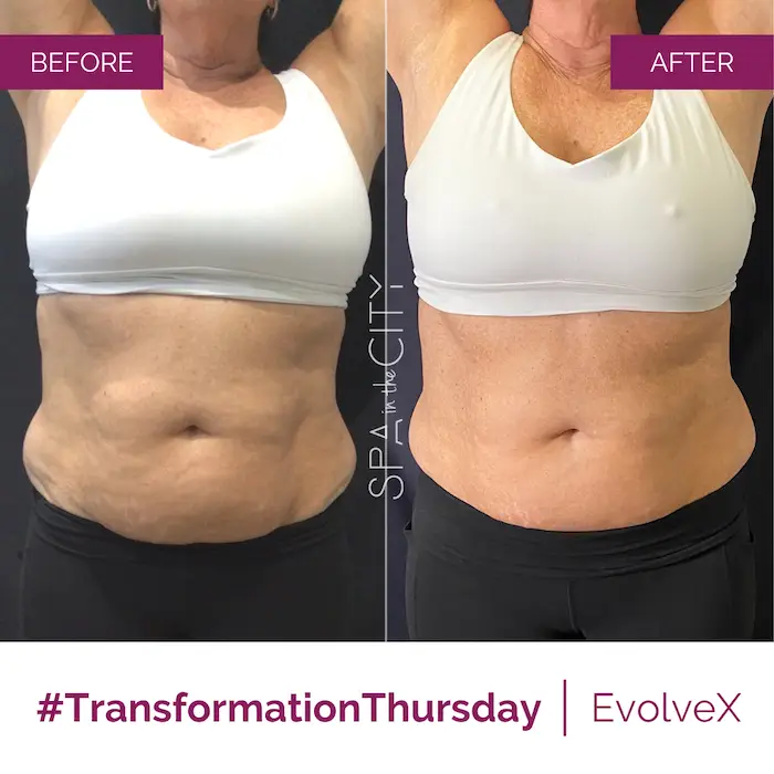 SITC-BA-EvolveX-Transform one