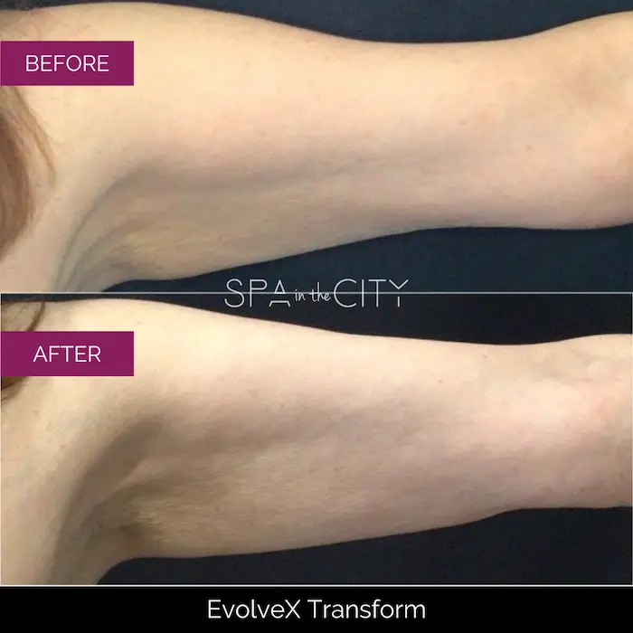 SITC-BA-EvolveX-Transform-two